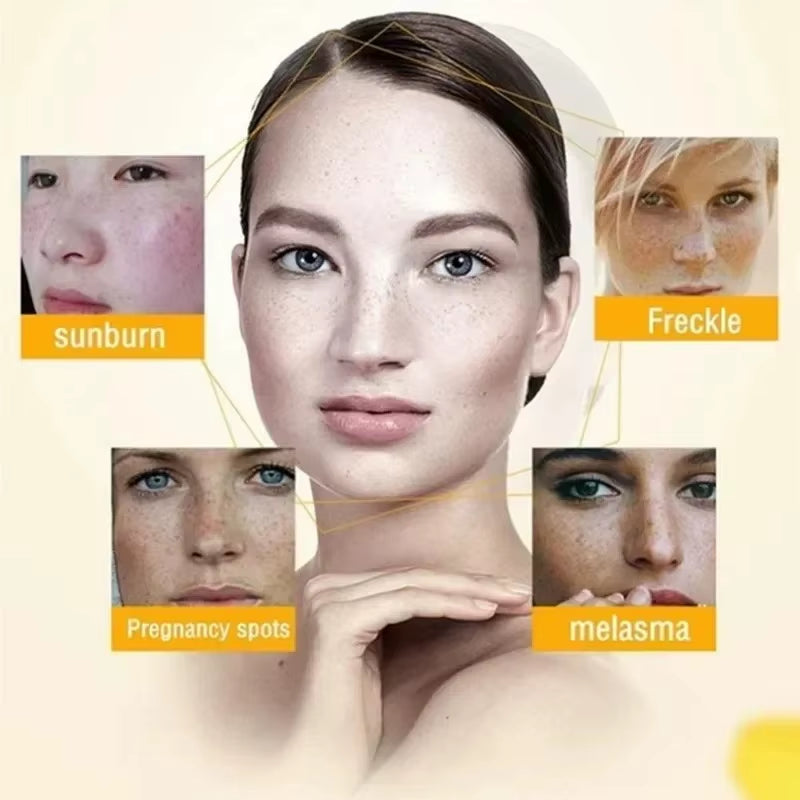 Niacinamide Brightening Cream — Fades Dark Spots & Pigmentation (20g)