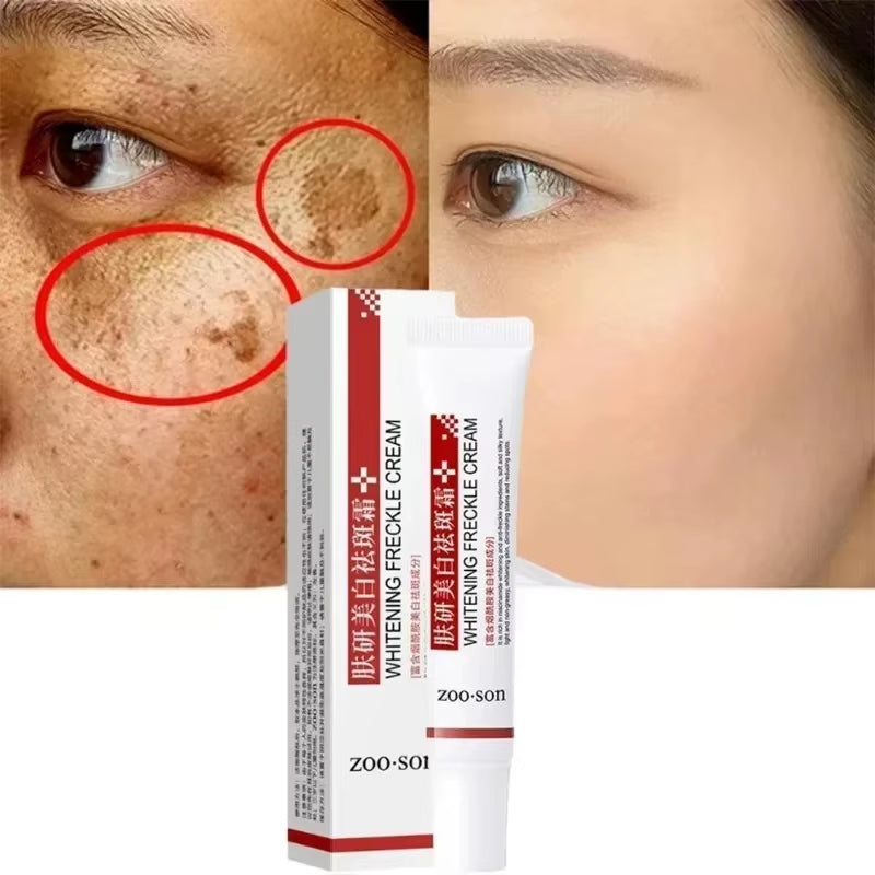 Niacinamide Brightening Cream — Fades Dark Spots & Pigmentation (20g)