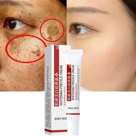 Niacinamide Brightening Cream — Fades Dark Spots & Pigmentation (20g)