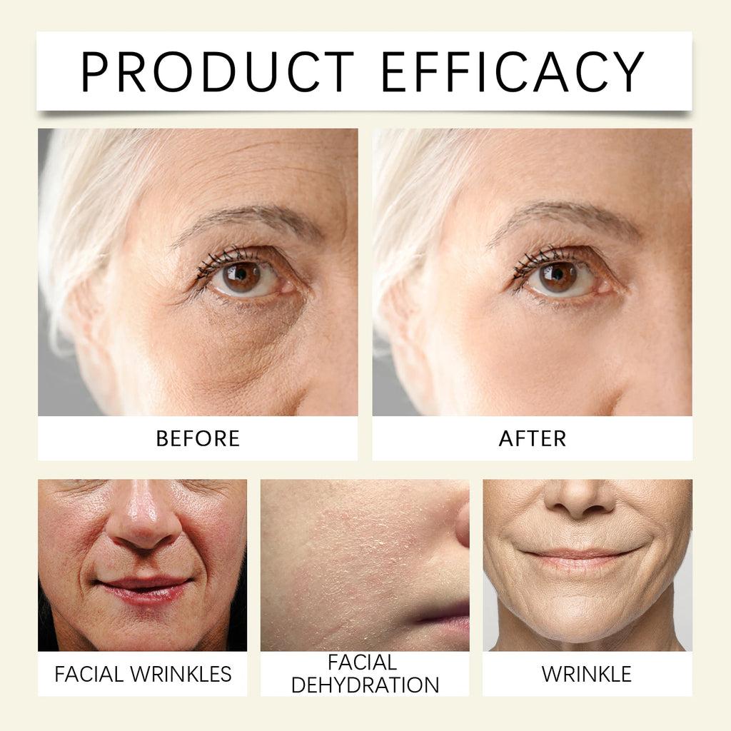 Snail Collagen Face Cream – Repair, Lift & Firm Moisturizer, Korean Skincare