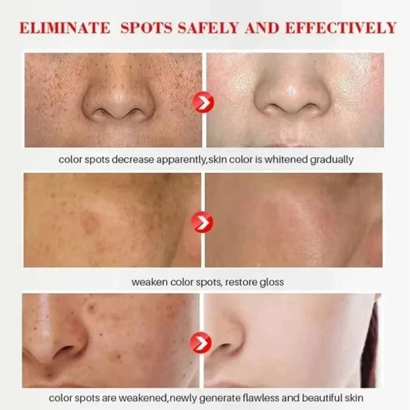 Niacinamide Brightening Cream — Fades Dark Spots & Pigmentation (20g)